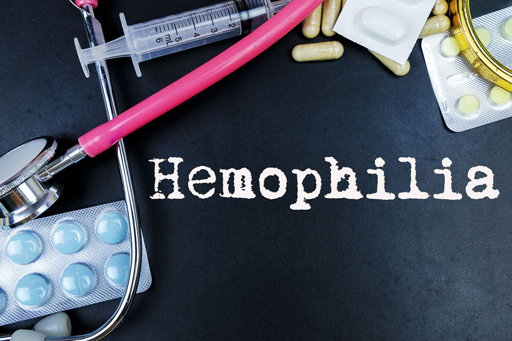 Treatment Procedures for Hemophilia